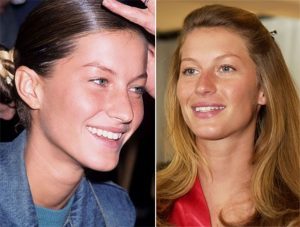 Gisele Bundchen Plastic Surgery Photos Subtle Changes Over The Years The Law